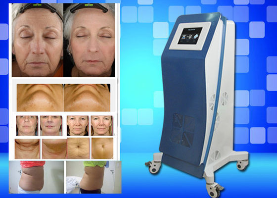 Cryo замерзая вес оборудования лазера Lipo теряет домашнюю машину красотки